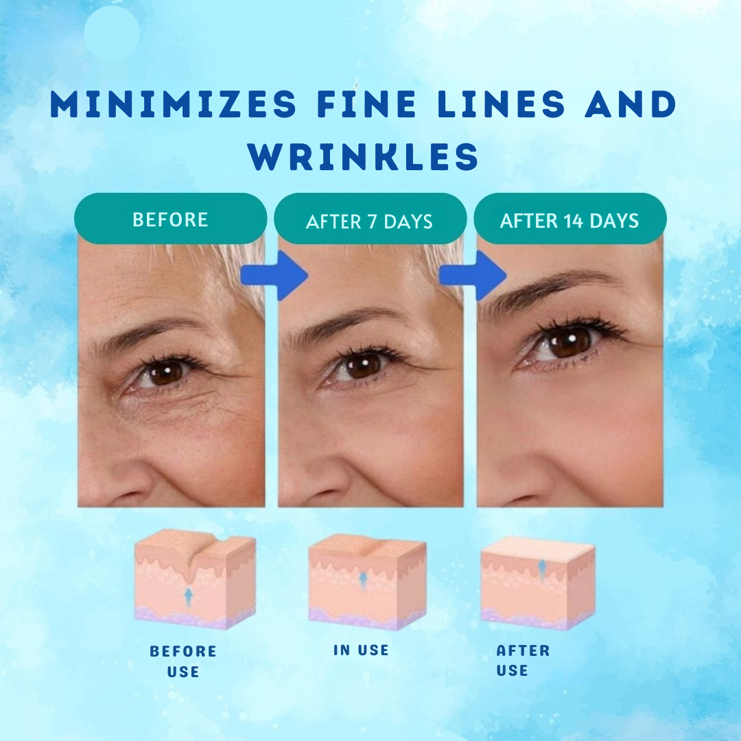 Ορός Botox ελιξίριο ενάντια στις ρυτίδες έντονα 