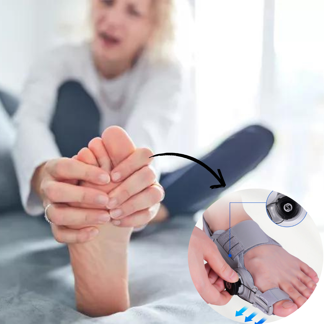Correggi i tuoi bunions senza dolore né intervento 